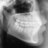 Radiologia Odontológica em São Luís