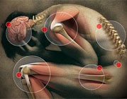Tratamento de Dor em São Luís