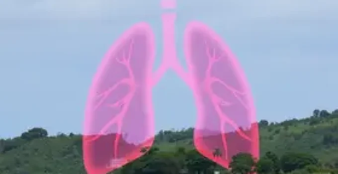 câncer de pulmão em São Luís
