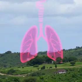 câncer de pulmão em São Luís